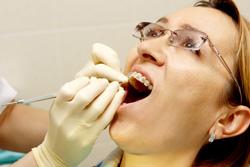 photo of woman having orthodontic work